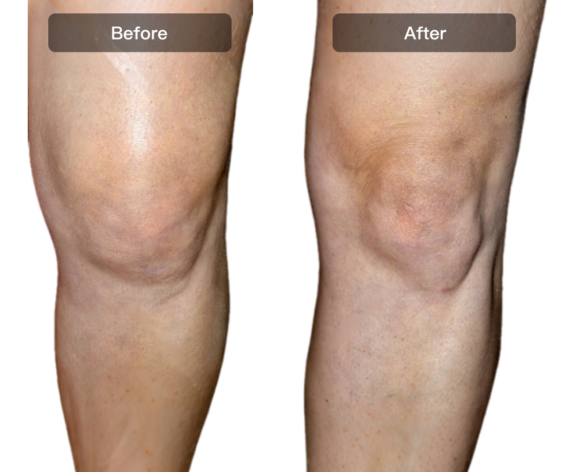 Soothe Pain & Reduce Inflammation in 7 Days.