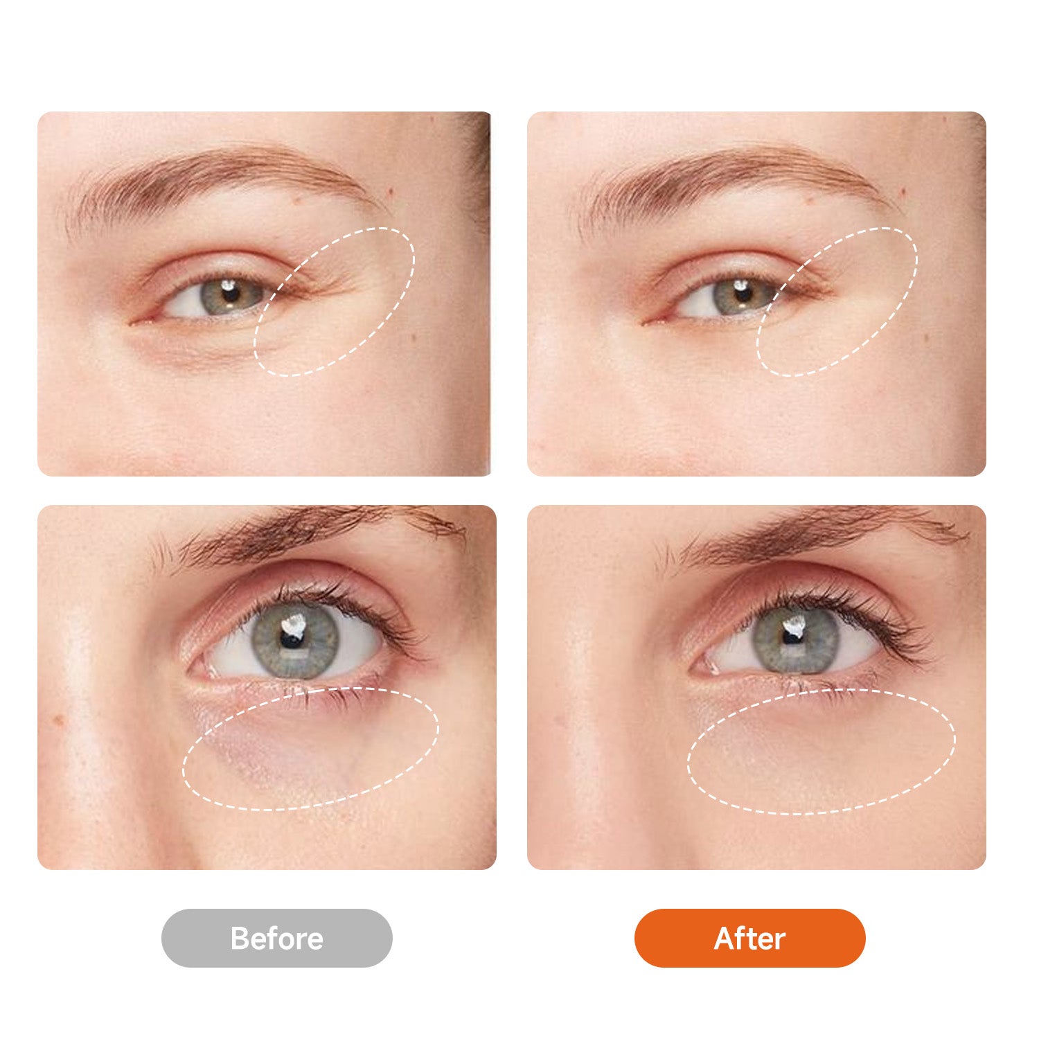 Red Light Therapy Eye Mask