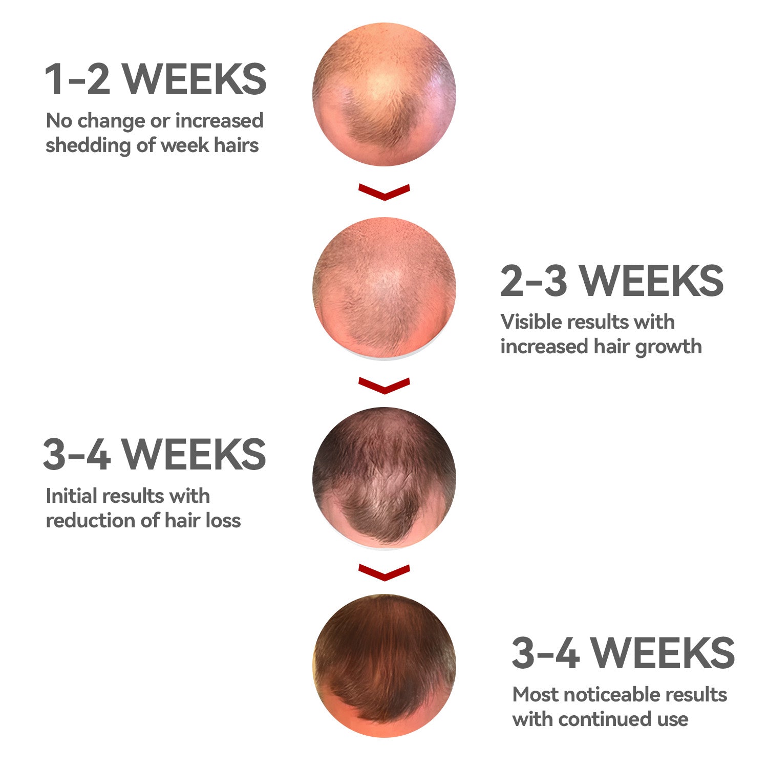 Swirise Red Light Therapy Cap