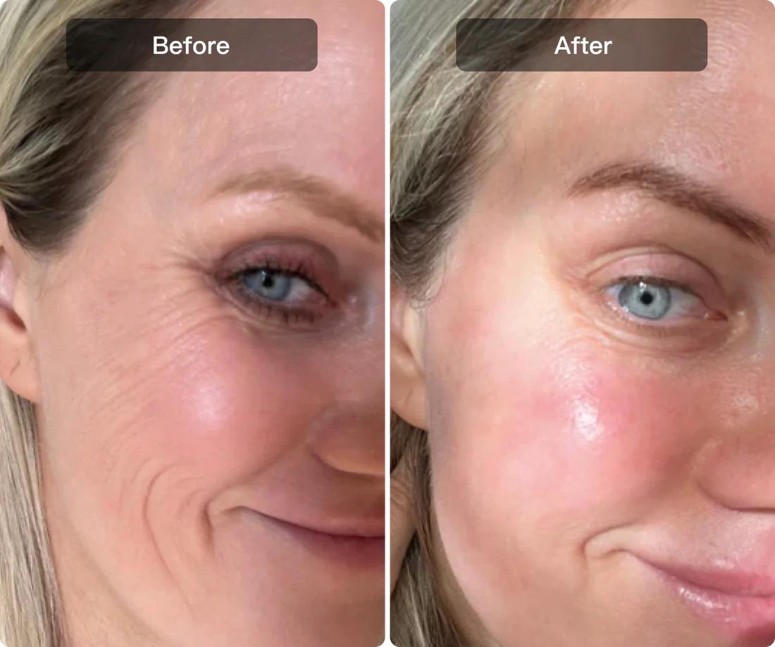 Smooth Wrinkles and Fine Lines in 3 Weeks.