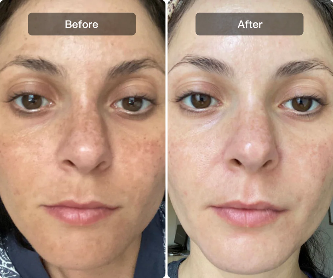 More even-looking complexion support