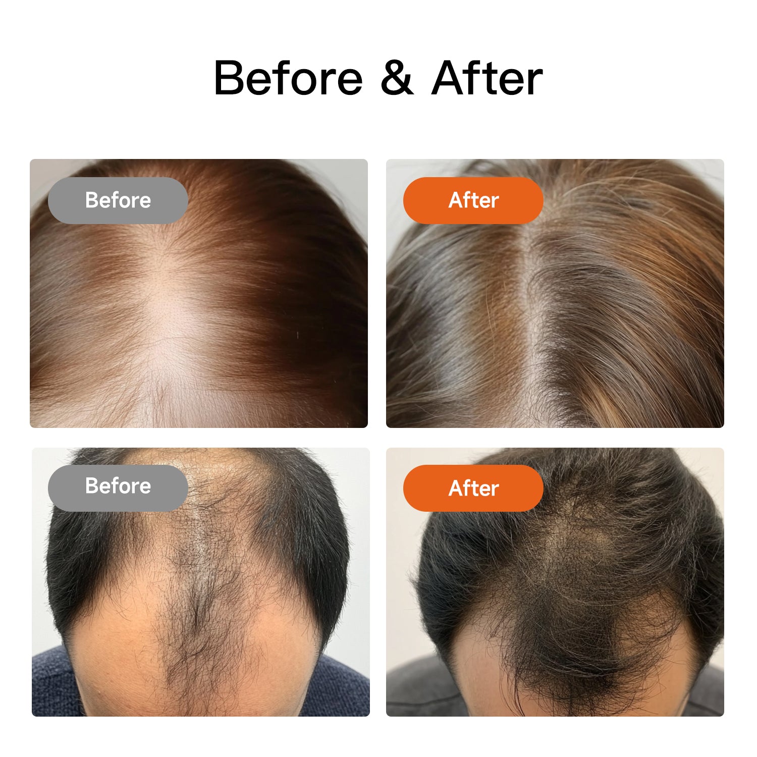 Swirise Red and Infrared Light Therapy Cap