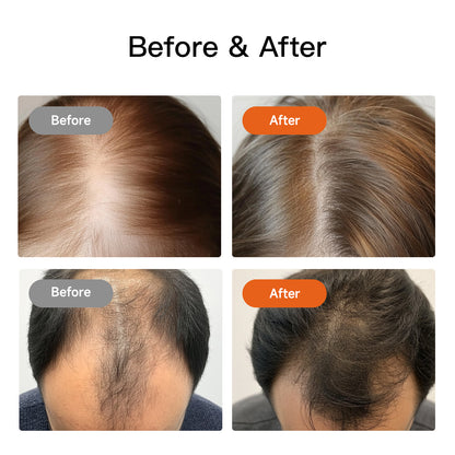 Swirise Red and Infrared Light Therapy Cap